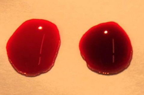 The bright red drop of blood on the left is oxygenated while the drop on the right is deoxygenated